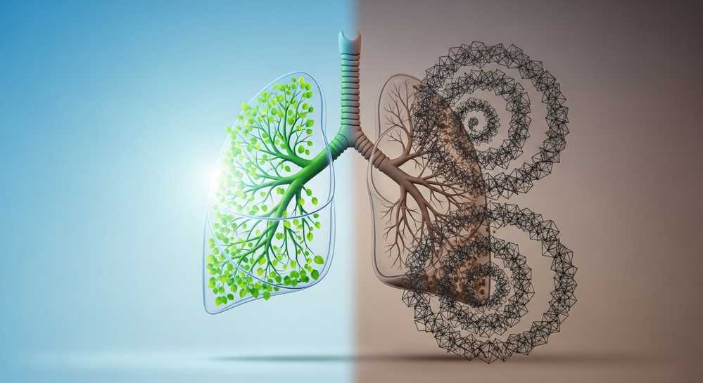 Định nghĩa ô nhiễm không khí là gì một cách khoa học